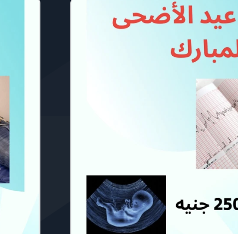 السونار